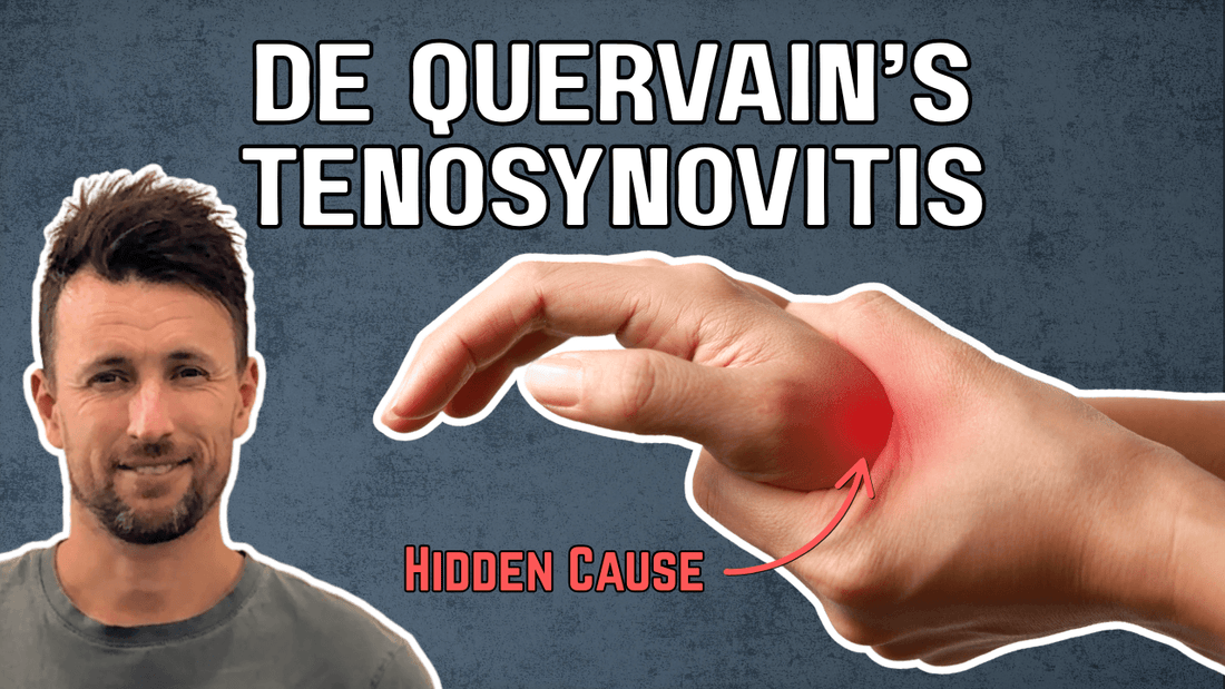 De Quervain's Tenosynovitis: The Hidden Neck Connection Most People Miss
