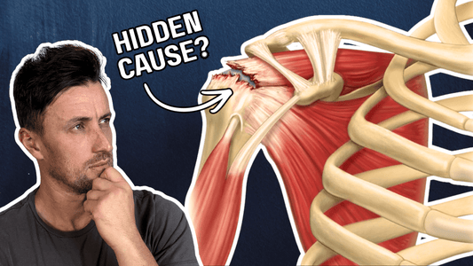 Fix These Hidden Issues to Instantly Improve Rotator Cuff Pain