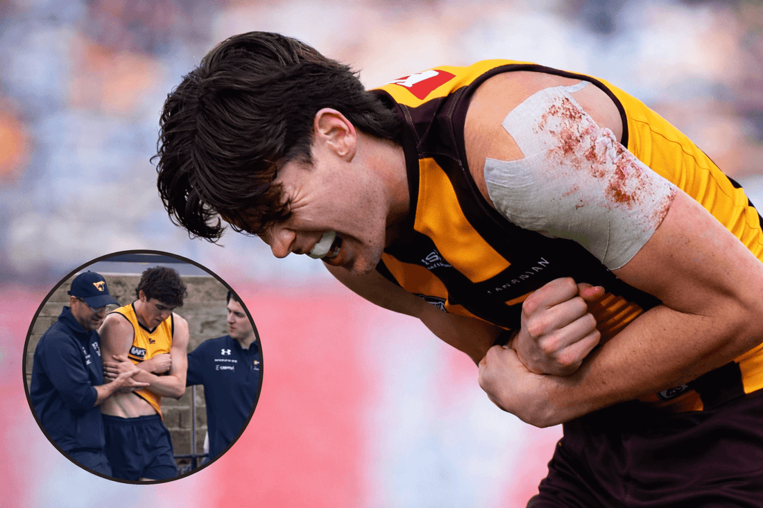 Will Day's Injury: Why Injuries Happen & the Deeper Question We Should Ask