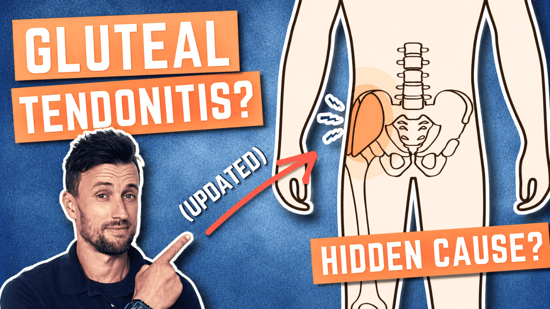 The Hidden Cause of Gluteal Tendonitis and How to Self-Treat
