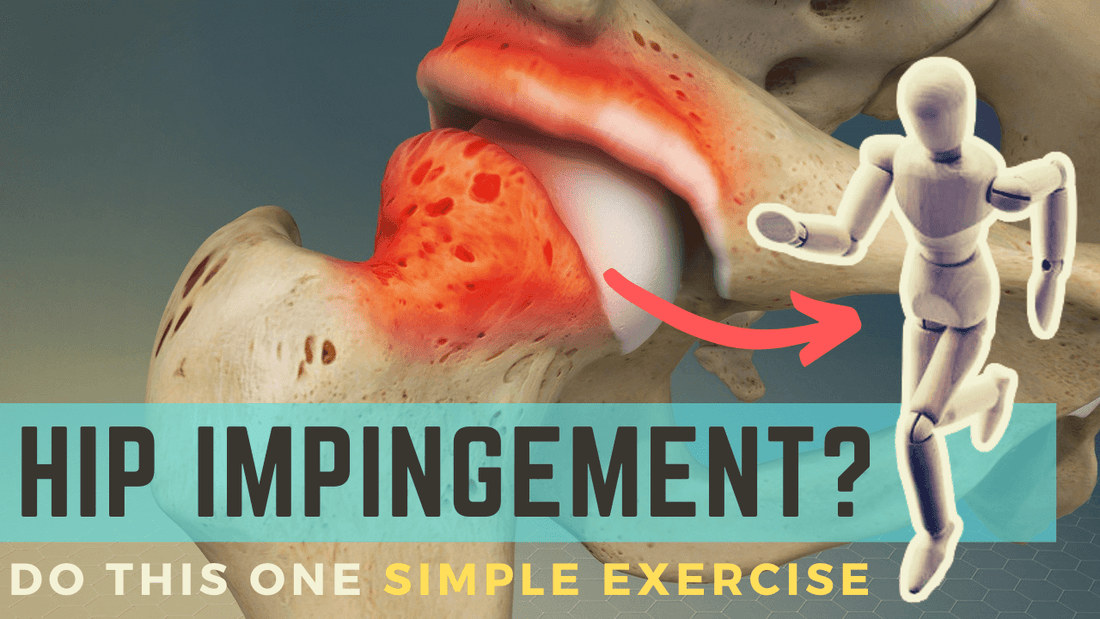 hip joint capsule stretch for femoroacetabular impingement