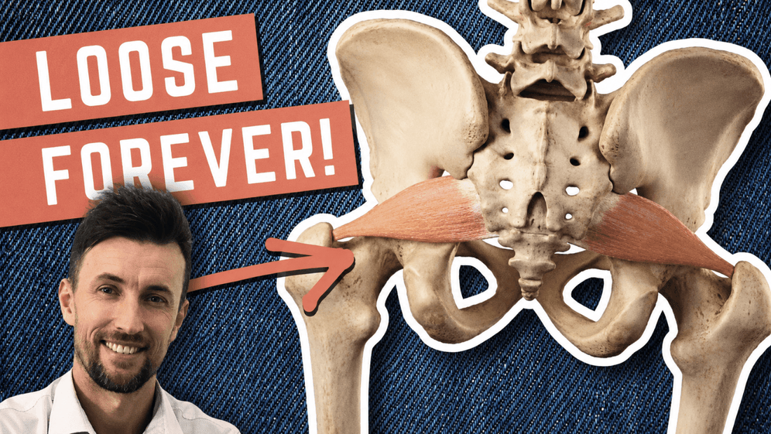 How to Permanently Loosen a Tight Piriformis