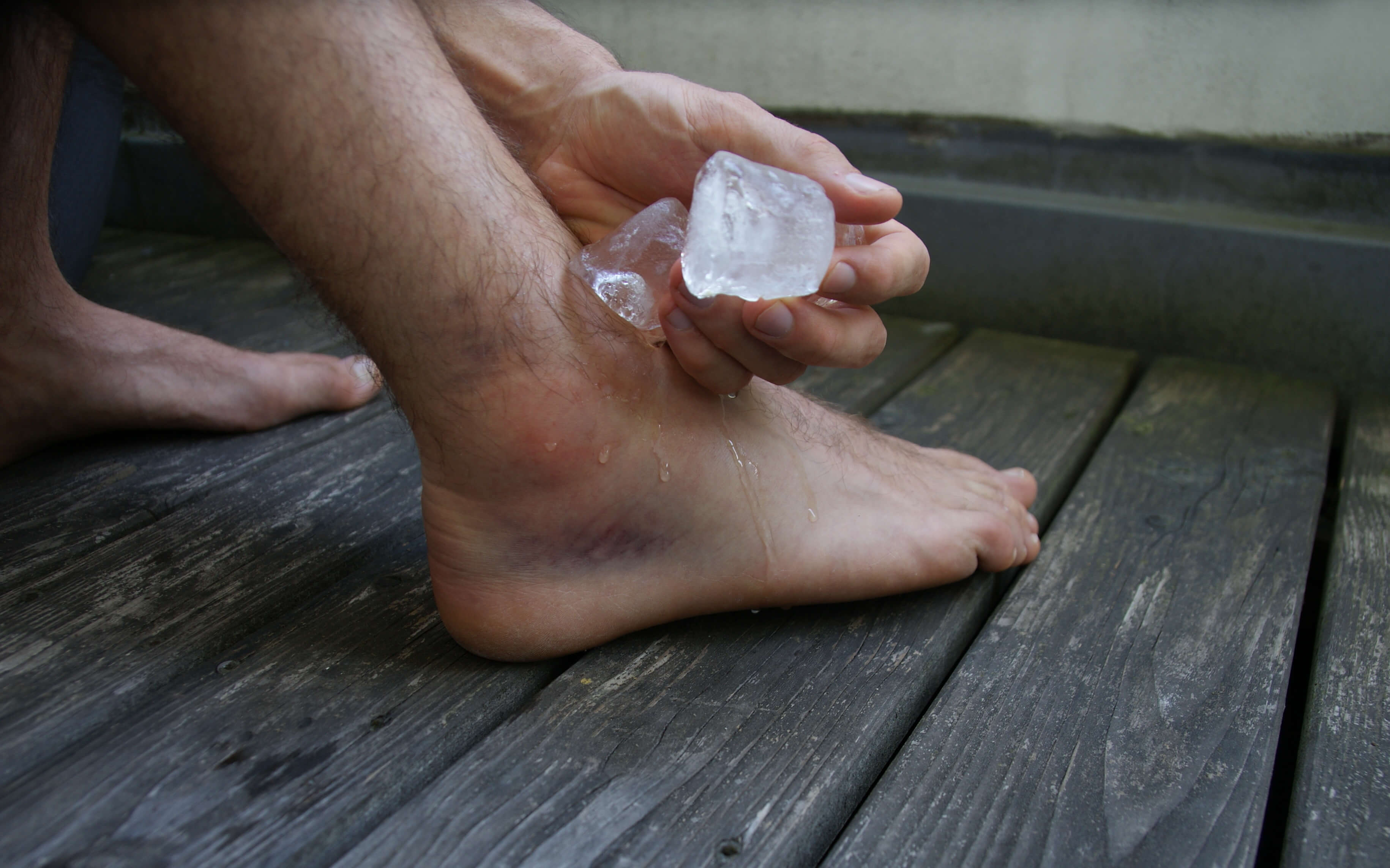 Why You Shouldn T Ice An Injury The Surprising Science Behind The Ric