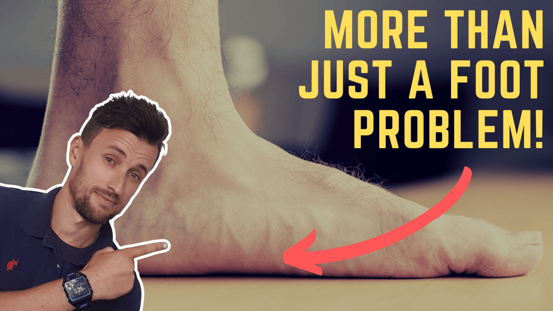 flat feet are a consequence of something else